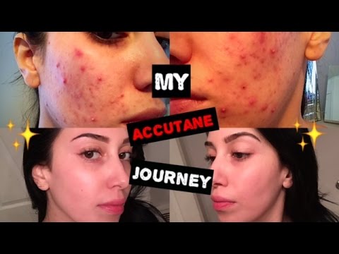 Deflamon Levné isotretinoin — s mastercard online